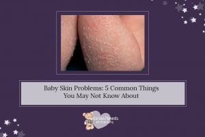 Baby Skin Problems: 5 Common Things You May Not Know About